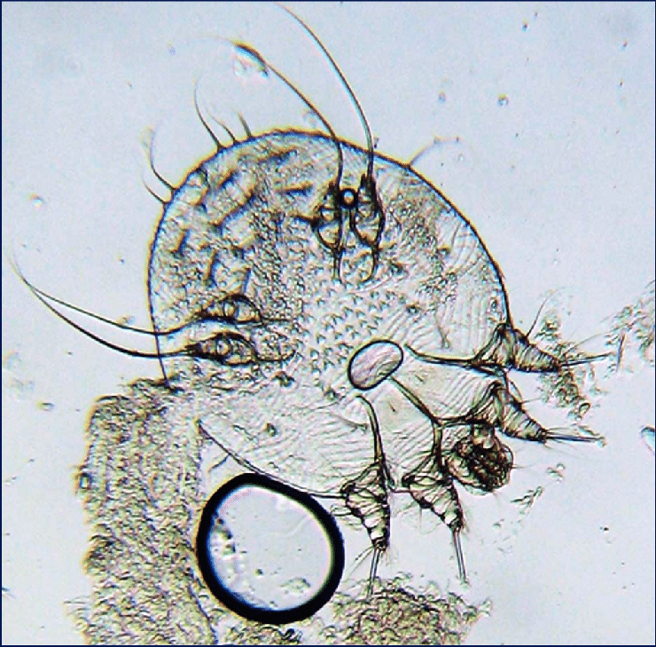 Scabies mite under microscope
