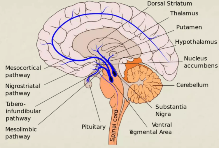 Risperidone induced Extrapyramidal Side Effects- Nigrostriatal Pathway: This pathway connects the substantia nigra to the striatum. It plays a key role in regulating voluntary movement. Blockade of dopamine in this pathway by antipsychotics like risperidone can lead to EPS, including tremors, rigidity, and bradykinesia (slow movement). Mesolimbic Pathway: This pathway runs from the ventral tegmental area (VTA) to the limbic system, which is involved in regulating emotions and reward. Dopamine blockade here helps reduce positive symptoms of schizophrenia, but it doesn't directly cause EPS. Mesocortical Pathway: This connects the VTA to the prefrontal cortex and is involved in cognition and emotional regulation. Dopamine disruption in this pathway can worsen negative symptoms or cognitive deficits but is not primarily involved in EPS. Tuberoinfundibular Pathway: This pathway runs from the hypothalamus to the pituitary gland, controlling prolactin secretion. Dopamine blockade here increases prolactin levels, but this pathway isn't directly related to EPS.
