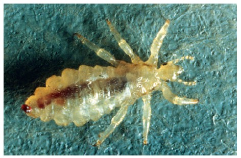 best-head-lice-treatment-