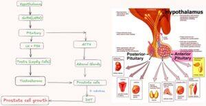 The pituitary-gonadal axis regulates benign prostatic hyperplasia through endocrine mechanisms. The pituitary-gonadal axis is crucial for regulating prostate growth. Neurons in the preoptic region

The hypothalamus secretes GnRH, also known as LHRH. LHRH, a short peptide, binds to surface receptors on pituitary cell plasma membranes. LHRH stimulates the pituitary gland to produce both LH and FSH. LH secretion stimulates testosterone production by the testicular Leydig cells. Testosterone inhibits LHRH at the hypothalamic and pituitary levels. The adrenals produce just about 1% of circulating testosterone.
Testosterone diffuses into prostatic cells and is transformed to DHT by 5α-reductase. DHT binds.
Testosterone diffuses into prostatic cells and is transformed to DHT by 5α-reductase. DHT binds to steroid receptors in the prostate nucleus, promoting cell proliferation. ACTH, also known as corticotropin. (Reprinted with permission from Berry, SJ et al. The development of human benign prostatic hyperplasia
with age. J Urol. 1984;132:474.)